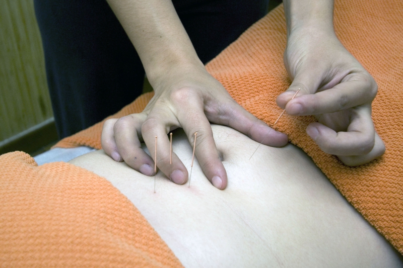 osteopathe-PIGNANS-min_acupuncture-4175625